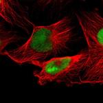 IFI16 Antibody in Immunocytochemistry (ICC/IF)