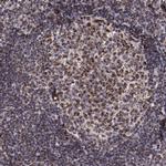 LONP1 Antibody in Immunohistochemistry (IHC)