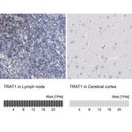 TRIM Antibody in Immunohistochemistry (IHC)