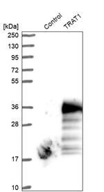 TRIM Antibody in Western Blot (WB)