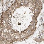 eIF1AX Antibody in Immunohistochemistry (IHC)