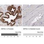 MIPOL1 Antibody in Immunohistochemistry (IHC)