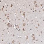 OPHN1 Antibody in Immunohistochemistry (IHC)