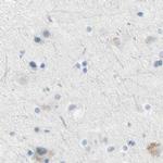 ASB9 Antibody in Immunohistochemistry (IHC)