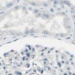 ASB9 Antibody in Immunohistochemistry (IHC)