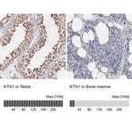 KTN1 Antibody