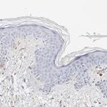 tPA Antibody in Immunohistochemistry (IHC)