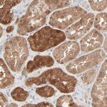 Galectin 2 Antibody in Immunohistochemistry (IHC)