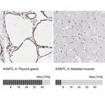 ASMTL Antibody