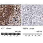 WIPF1 Antibody in Immunohistochemistry (IHC)