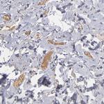 Factor XIII B Antibody in Immunohistochemistry (IHC)