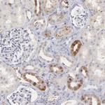 Factor XIII B Antibody in Immunohistochemistry (IHC)