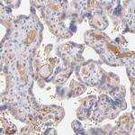 Factor XIII B Antibody in Immunohistochemistry (IHC)