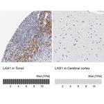 LAX1 Antibody in Immunohistochemistry (IHC)