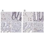 ADAR Antibody in Immunohistochemistry (IHC)