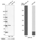 p41-ARCb Antibody