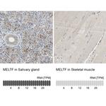 MFI2 Antibody in Immunohistochemistry (IHC)
