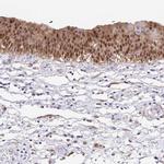 Annexin A10 Antibody in Immunohistochemistry (IHC)