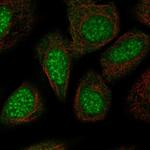 TRIP13 Antibody in Immunocytochemistry (ICC/IF)