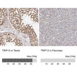 TRIP13 Antibody in Immunohistochemistry (IHC)