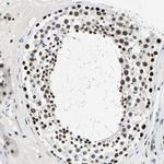 MORF Antibody in Immunohistochemistry (IHC)