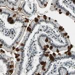 MORF Antibody in Immunohistochemistry (IHC)