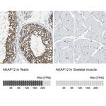 AKAP12 Antibody in Immunohistochemistry (IHC)