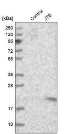 JTB Antibody in Western Blot (WB)