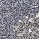 ZHX2 Antibody in Immunohistochemistry (IHC)