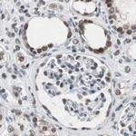 ZHX2 Antibody in Immunohistochemistry (IHC)