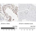 ZFC3H1 Antibody in Immunohistochemistry (IHC)