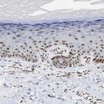 ZFC3H1 Antibody in Immunohistochemistry (IHC)