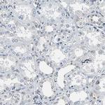 LSR Antibody in Immunohistochemistry (IHC)