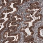 LSR Antibody in Immunohistochemistry (IHC)