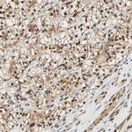 WWTR1 Antibody in Immunohistochemistry (IHC)