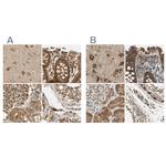 MRPS22 Antibody in Immunohistochemistry (IHC)