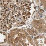 MRPS22 Antibody in Immunohistochemistry (IHC)