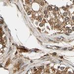 MRPS22 Antibody in Immunohistochemistry (IHC)