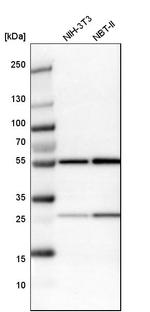 LAP2 Antibody in Western Blot (WB)