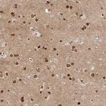 OMG Antibody in Immunohistochemistry (IHC)