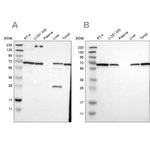 LTA4H Antibody in Western Blot (WB)