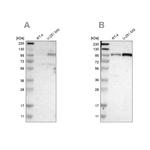 UNC84A Antibody in Western Blot (WB)
