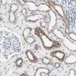 SLC22A2 Antibody in Immunohistochemistry (IHC)