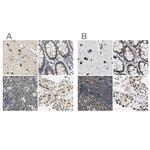 POGZ Antibody in Immunohistochemistry (IHC)