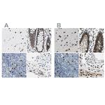 NFIA Antibody in Immunohistochemistry (IHC)