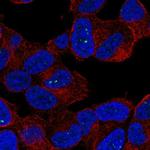 SLC27A6 Antibody in Immunocytochemistry (ICC/IF)