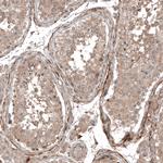 COL12A1 Antibody in Immunohistochemistry (IHC)