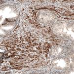 COL12A1 Antibody in Immunohistochemistry (IHC)