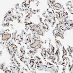 CD93 Antibody in Immunohistochemistry (IHC)