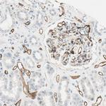 CD93 Antibody in Immunohistochemistry (IHC)